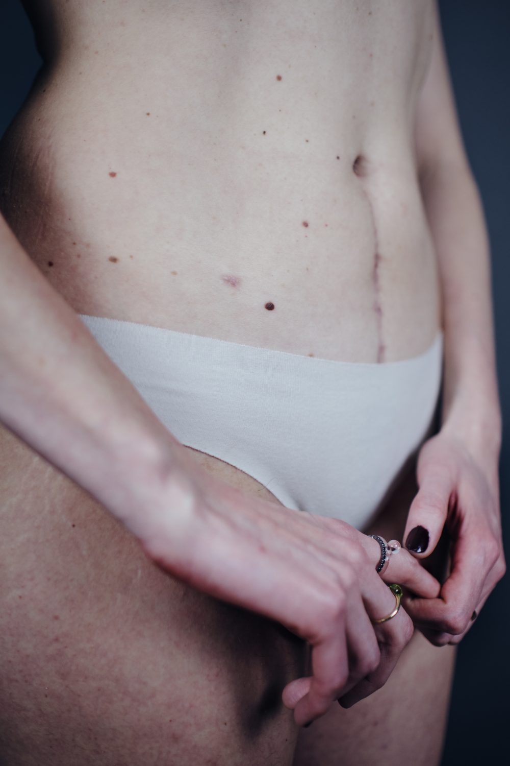 BODY