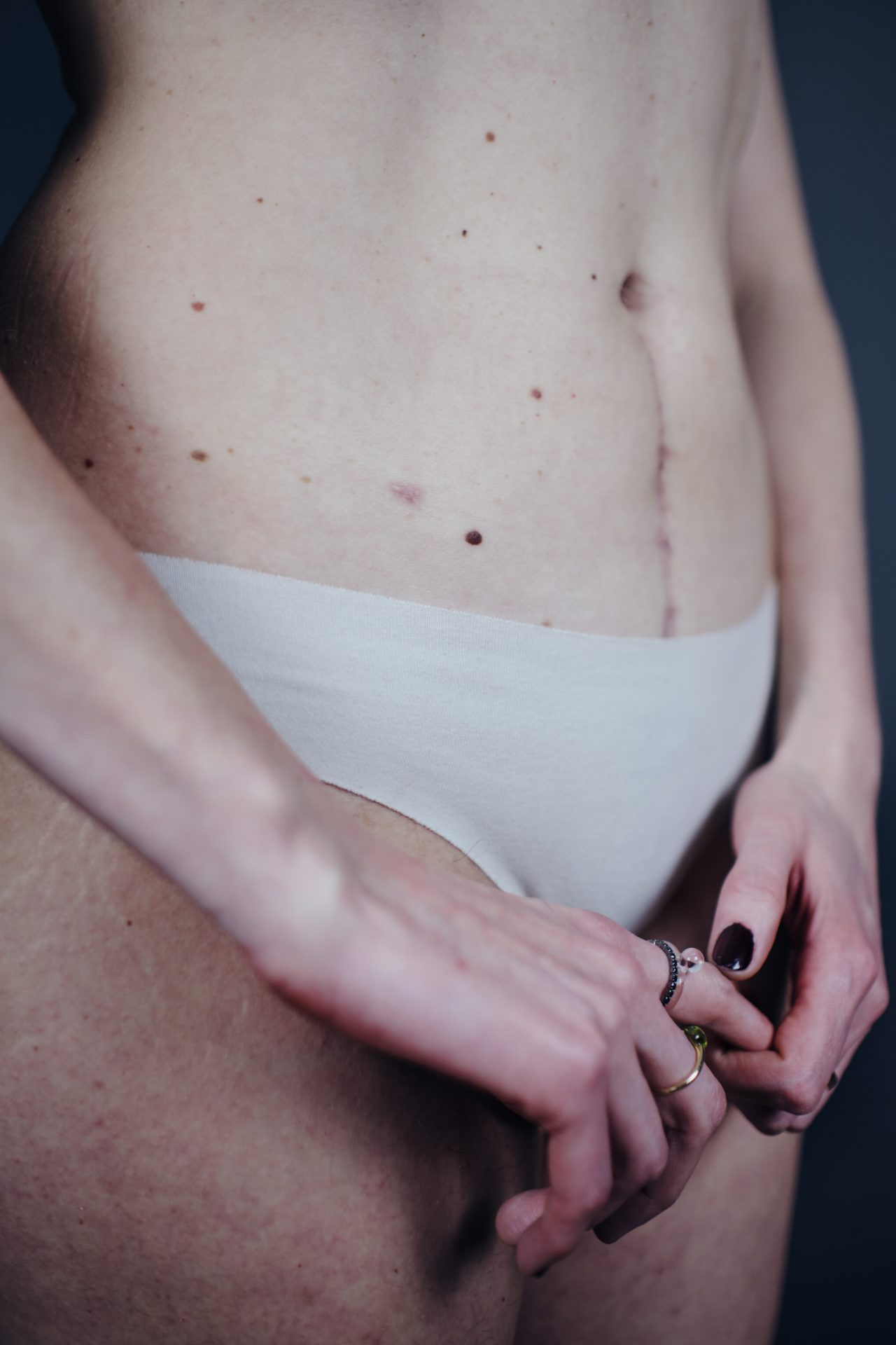 BODY